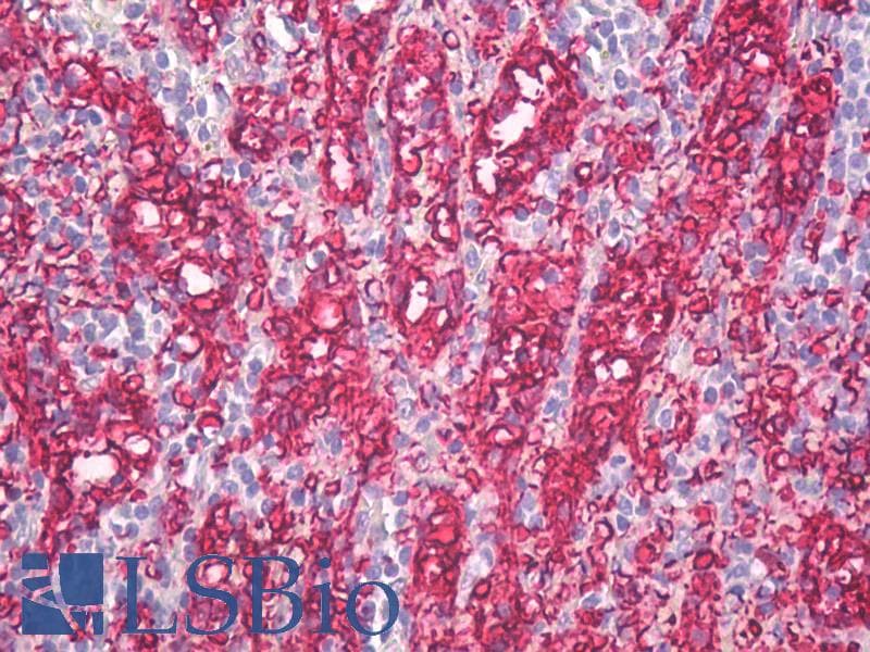 IHC-plus™ Blood Group A Antibody