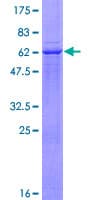 Human ADAM22 Protein (Recombinant GST)