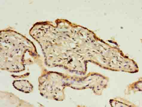 C1QTNF6 / CTRP6 Antibody