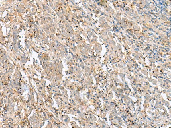 FLOT2 / Flotillin 2 Antibody