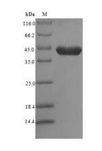 Mouse YWHAZ / 14-3-3 Zeta Protein (Recombinant 6His-SUMO, N-terminus)