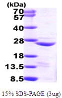 Human COMMD1 Protein (Recombinant His)
