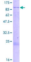 Human KLHL4 Protein (Recombinant GST)