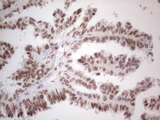 NR2C2 / TAK1 Antibody (aa1-241, clone OTI4B1)