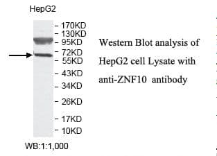 ZNF10 / KOX1 Antibody (aa20-242)