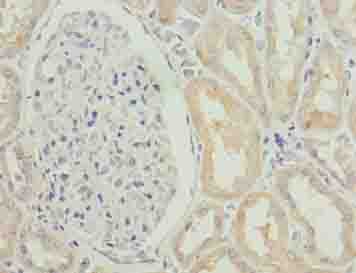 HIST2H2AC Antibody