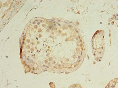 GPCRW / GPR18 Antibody