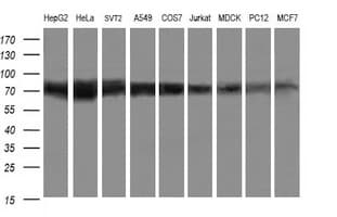IHC-plus™ GLB1 / Beta-Galactosidase Antibody (clone 10B2)