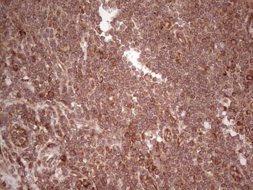 Monoclonal Mouse anti-Human LAMB3 / Laminin Beta 3 Antibody (clone OTI1D3, aa22-315, IHC)
