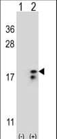 Polyclonal Rabbit anti-Human COX6A1 Antibody (aa50-78, IHC, WB)