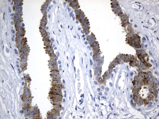 Monoclonal Mouse anti-Human AGR2 Antibody (clone UMAB245, aa21-175, IHC)