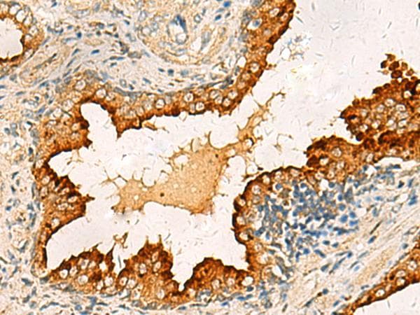 Polyclonal Rabbit anti-Human PDCL Antibody (IHC)