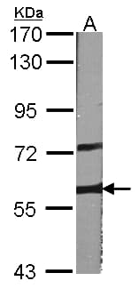 Polyclonal Rabbit anti-Human ARAF / ARAF1 / A-RAF Antibody (aa371-554, IHC, WB)