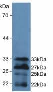 FOXO1 / FKHR Antibody (aa222-469)
