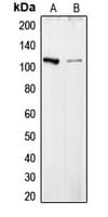 COL6A2 / Collagen VI Alpha 2 Antibody (Internal)
