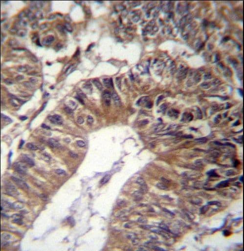 GCC1 / GCC88 Antibody (aa671-700)