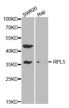 RPL5 / Ribosomal Protein L5 Antibody