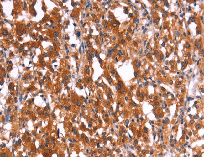 Polyclonal Rabbit anti-Human HMGCS2 / HMG-CoA Synthase 2 Antibody (IHC, WB)