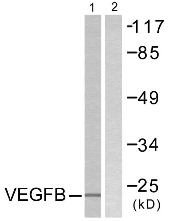 Polyclonal Rabbit anti-Human VEGFB Antibody (WB)