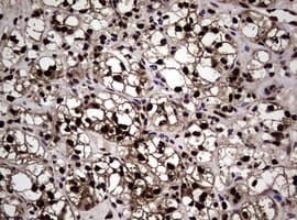 Monoclonal Mouse anti-Human NBN / Nibrin Antibody (clone OTI8E7, IHC, WB)