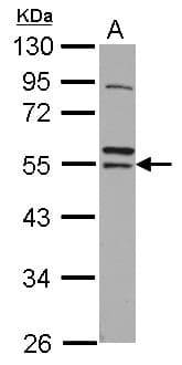 RNF14 / ARA54 Antibody