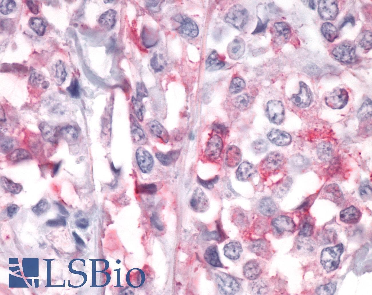 PathPlus™ PTPRA / RPTP-Alpha Antibody (Extracellular Domain)
