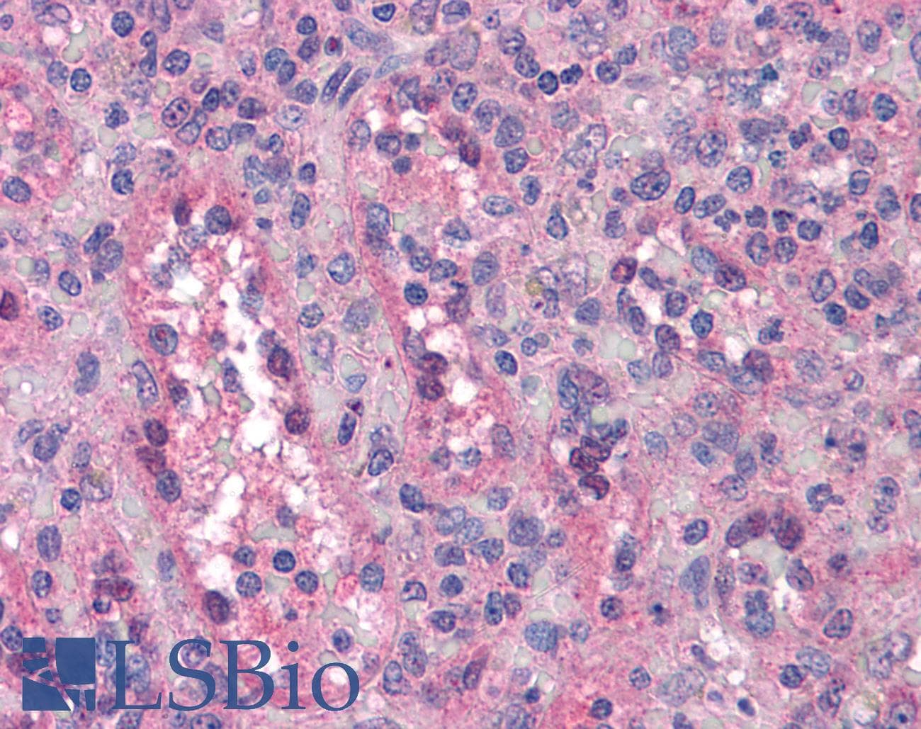 IHC-plus™ BUB1B / BubR1 Antibody