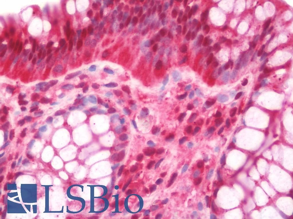 PSMB2 Antibody