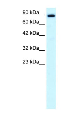 Polyclonal Rabbit anti-Human KIF21A Antibody (aa551-600, IHC, WB)
