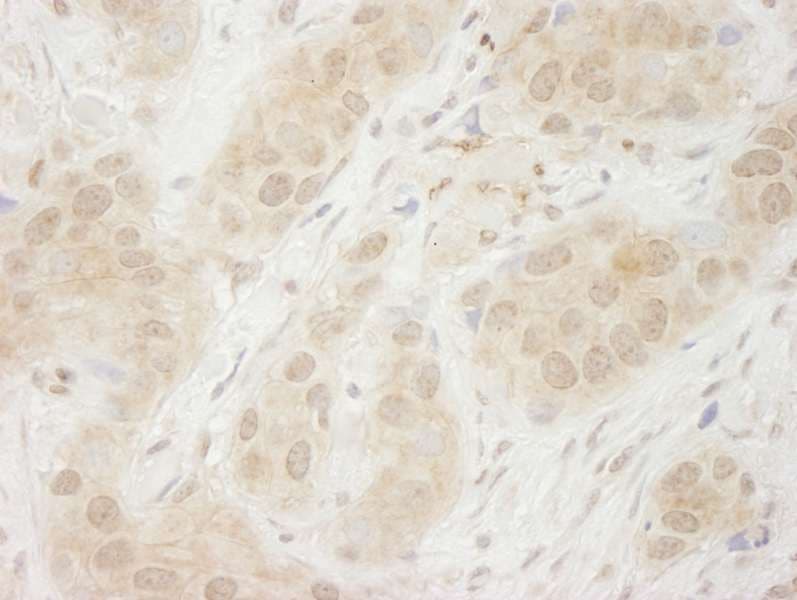 SYK Antibody (aa250-300)