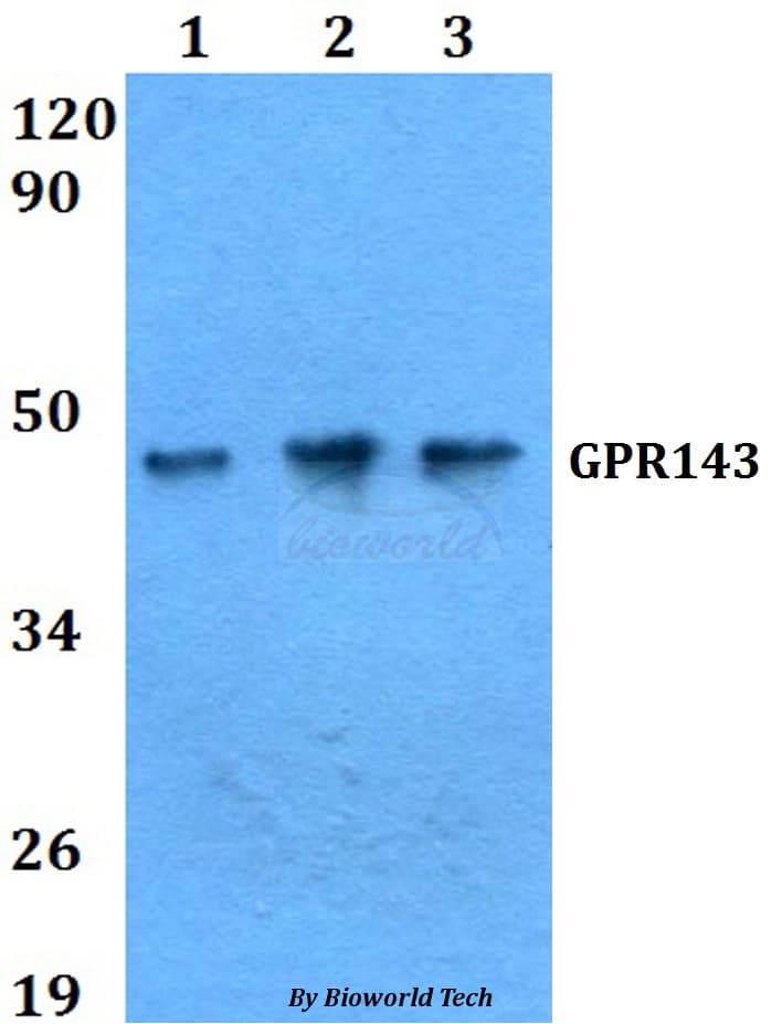 GPR143 Antibody