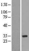 ZNF397 Protein (Over-Expression Lysate Myc-DDK (Flag))