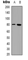 TEM1 / CD248 Antibody (Internal)