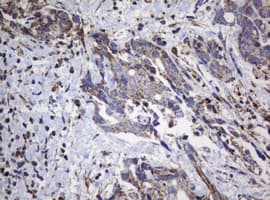 Monoclonal Mouse anti-Human NDUFB10 Antibody (clone OTI2G1, IHC, WB)