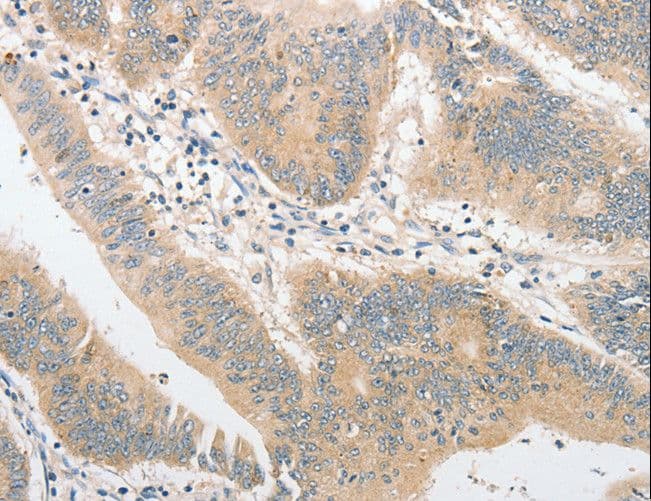 TLR4 Antibody