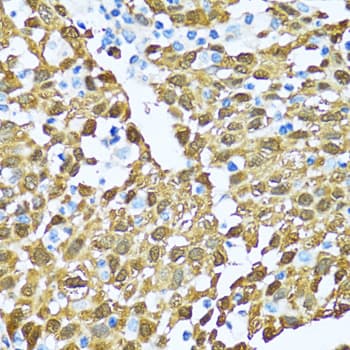 Polyclonal Rabbit anti-Human NOL3 / ARC Antibody (IHC, IF, WB)