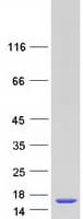 Human LSM5 Protein (Recombinant Myc-DDK (Flag))