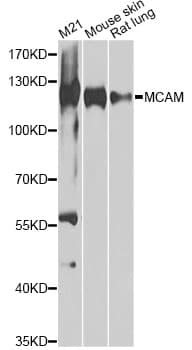 Polyclonal Rabbit anti-Human MCAM / CD146 Antibody (IHC, WB)