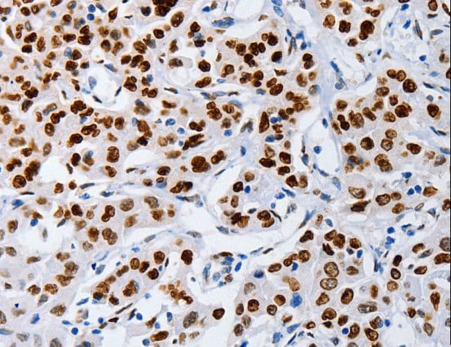 MUTYH / MYH Antibody