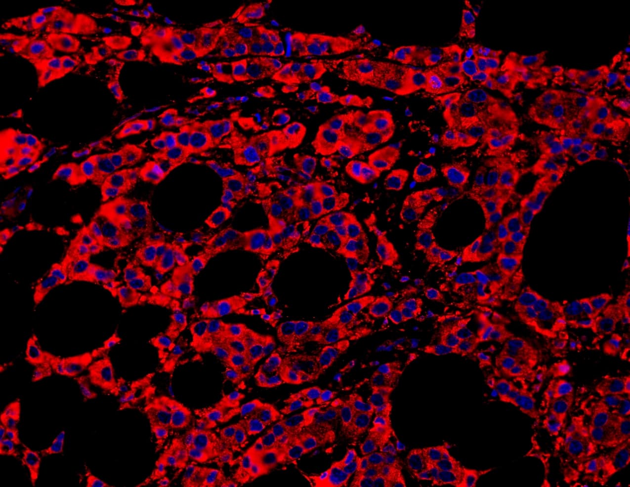 Polyclonal Rabbit anti-Human MYD88 Antibody (aa44-264, IHC, WB)