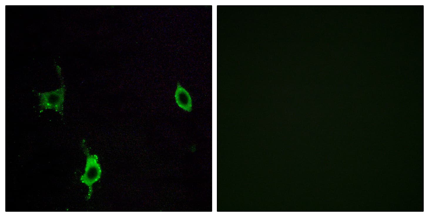 LAMC3 / Laminin Gamma 3 Antibody (aa1361-1410)