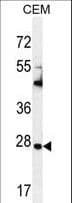 IHC-plus™ Polyclonal Rabbit anti-Human TIMP1 Antibody (aa157-188, IHC, IF, WB)