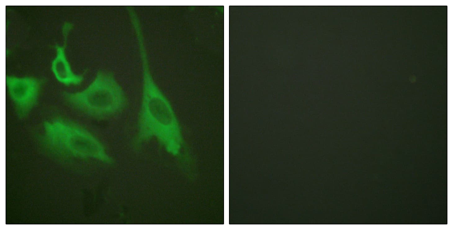Polyclonal Rabbit anti-Human HSP90 Beta Antibody (phospho-Ser254, IHC, IF, WB)