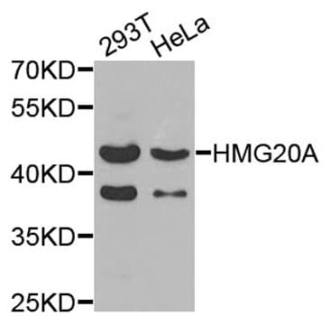 Polyclonal Rabbit anti-Human HMG20A Antibody (IHC, IF, WB)