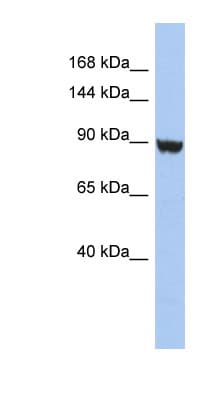 KCNH6 / Kv11.2 / ERG2 Antibody (aa827-876)