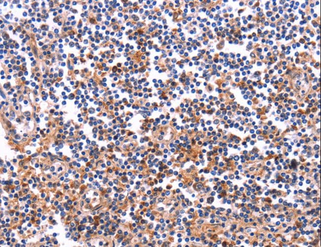 Polyclonal Rabbit anti-Human COL20A1 / Collagen XX Antibody (IHC)