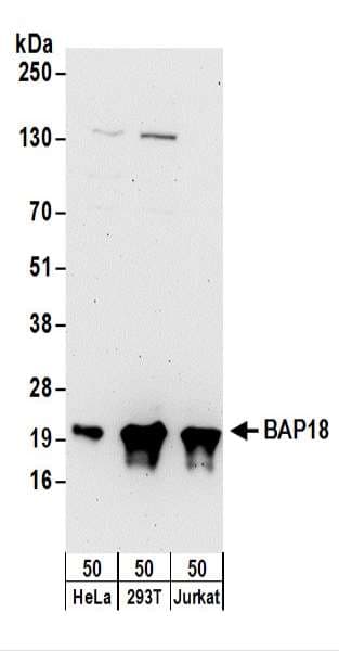 Polyclonal Rabbit anti-Human C17orf49 Antibody (aa122-172, WB)