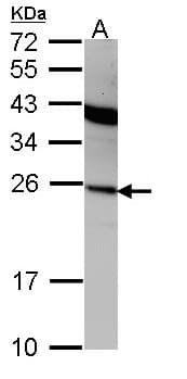 IHC-plus™ IFNA2 / Interferon Alpha 2 Antibody (aa125-188)
