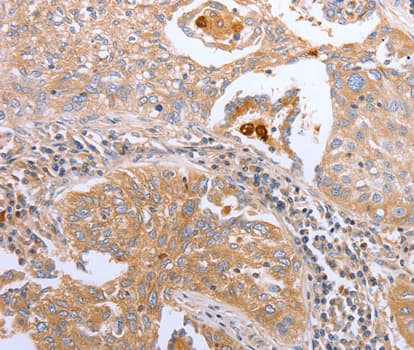CDK20 / CCRK Antibody