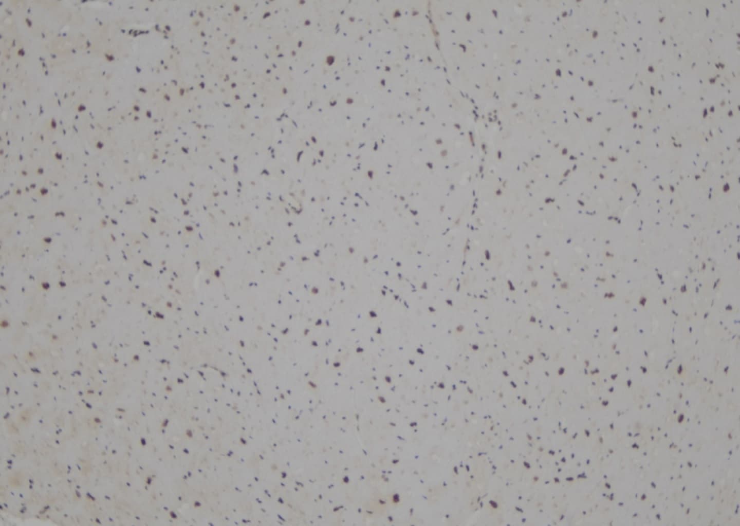 LHX1 Antibody